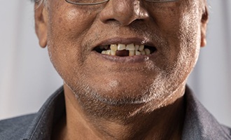  Man has missing teeth?