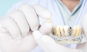 Massapequa Park implant dentist holding final restoration 