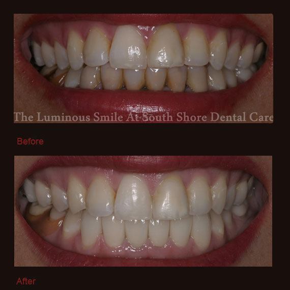 Smile Gallery | South Shore Dental Care