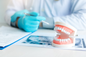 Dentist pointing to dentures on desk